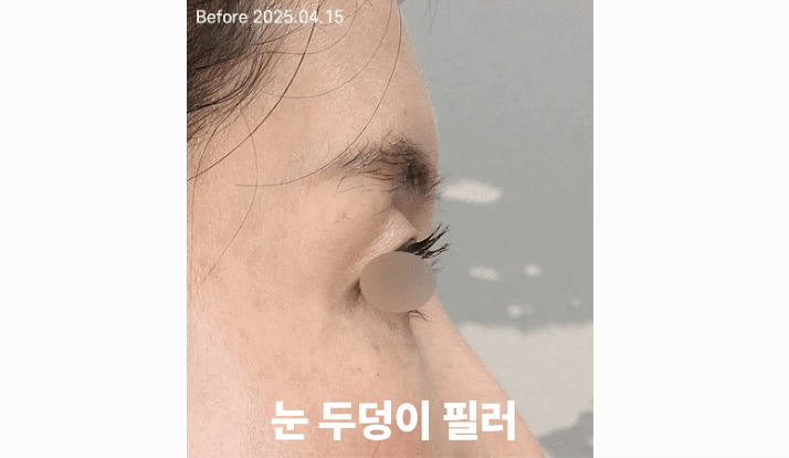 슬라이드2